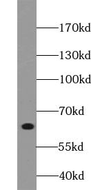 YTHDF2 Antibody - BSA Free
