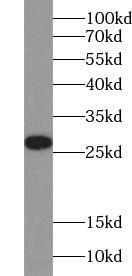 YIPF4 Antibody - BSA Free