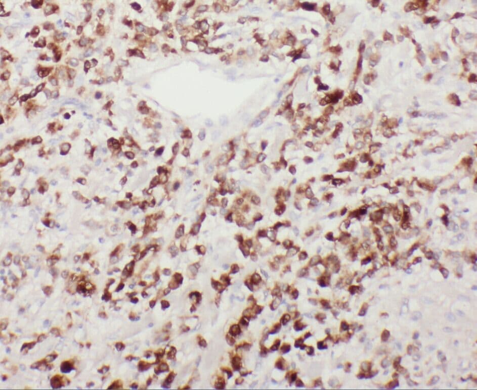 YIPF4 Antibody - BSA Free