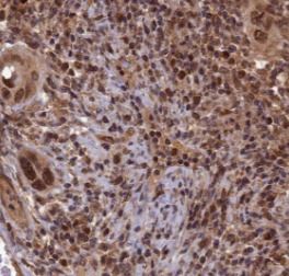 YEATS2 Antibody - BSA Free