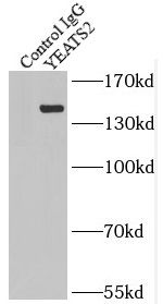 YEATS2 Antibody - BSA Free