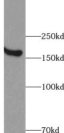 Xrn1 Antibody - BSA Free