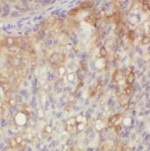 XPO6 Antibody - BSA Free