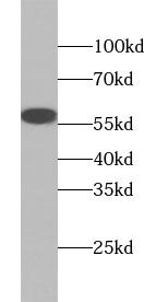 XPNPEP3 Antibody - BSA Free