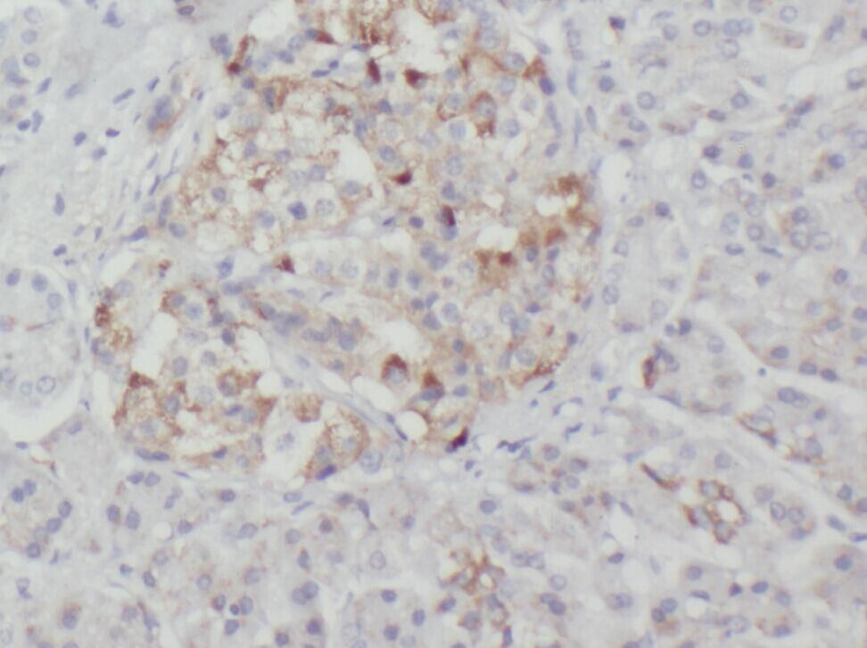 XK X-linked Kx blood group Antibody - BSA Free