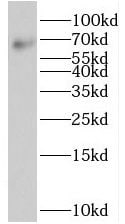 Suppression of Tumorigenicity 7 Antibody - BSA Free