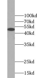 WIRE Antibody - BSA Free