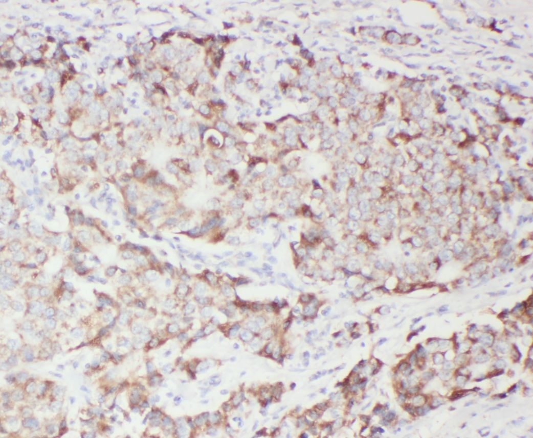WFDC1 Antibody - BSA Free