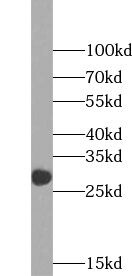 WFDC1 Antibody - BSA Free