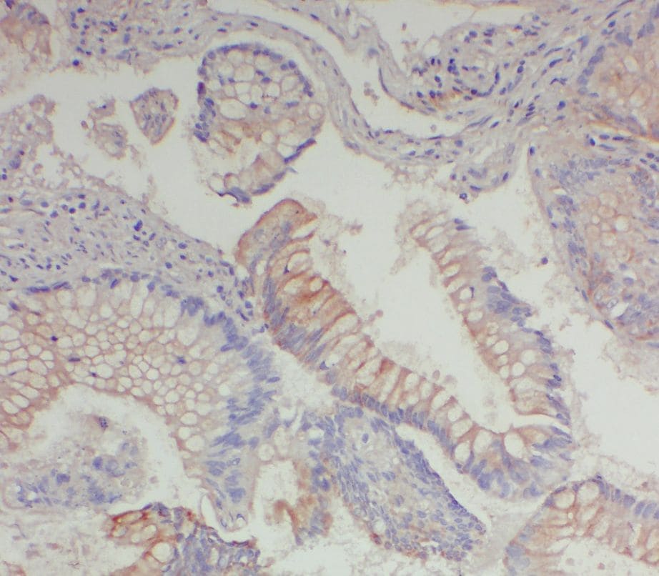 WDR92 Antibody - BSA Free