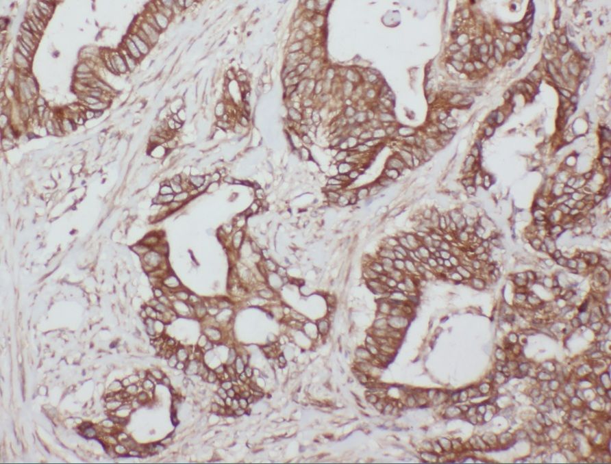 WDR55 Antibody - BSA Free