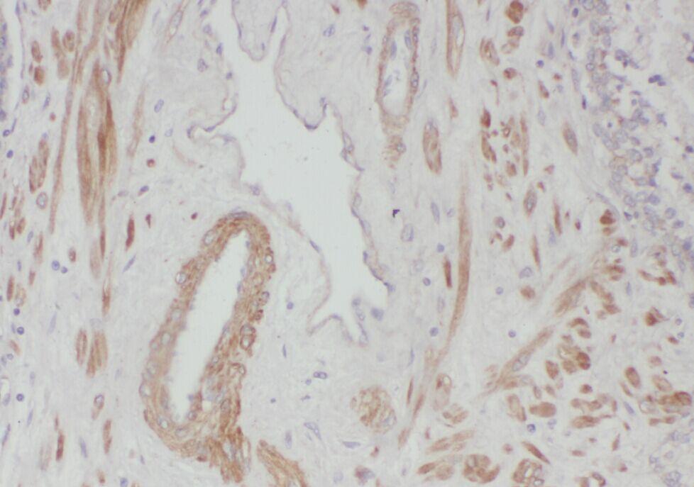 WDR19 Antibody - BSA Free