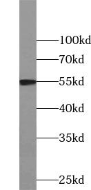 WARS2 Antibody - BSA Free