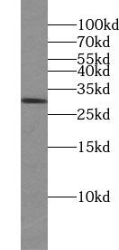 VTI1A Antibody - BSA Free
