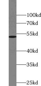 VRK3 Antibody - BSA Free