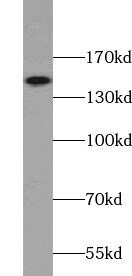 VPS8 Antibody - BSA Free