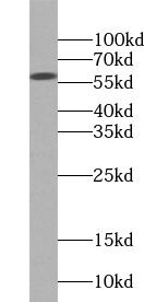 YL1 Antibody - BSA Free