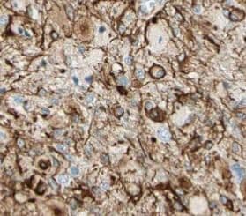 VPS52 Antibody - BSA Free