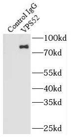 VPS52 Antibody - BSA Free