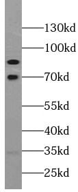 VPS52 Antibody - BSA Free