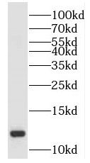 SH3BGRL2 Antibody - BSA Free