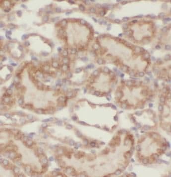 VPS33B Antibody - BSA Free