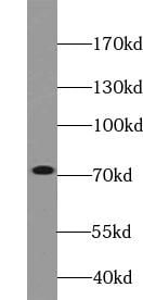 VPS33B Antibody - BSA Free