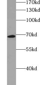 VPS33A Antibody - BSA Free