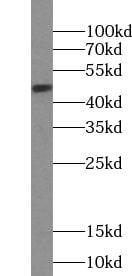 VPREB3 Antibody - BSA Free