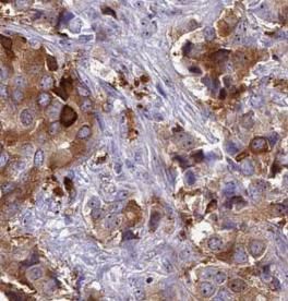 VprBP Antibody - BSA Free