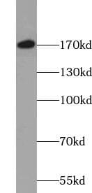 VprBP Antibody - BSA Free