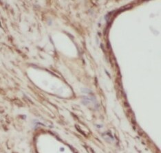 VRTN Antibody - BSA Free