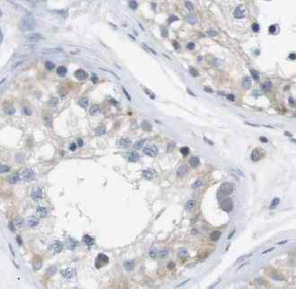 VDAC3 Antibody - BSA Free
