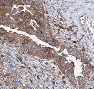 VARS2 Antibody - BSA Free