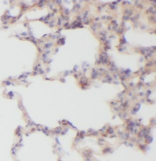 VAC14 Antibody - BSA Free
