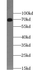 UTP6 Antibody - BSA Free