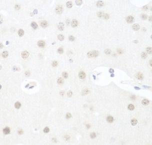 UTP14A Antibody - BSA Free