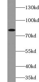 USP49 Antibody - BSA Free