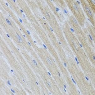 USP25 Antibody - BSA Free