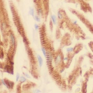 USP21 Antibody - BSA Free