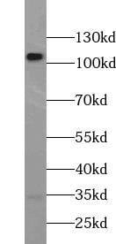 USP15 Antibody - BSA Free