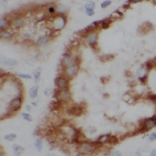 Uroguanylin Antibody - BSA Free