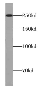 URB1 Antibody - BSA Free