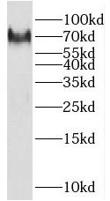 RHOBTB3 Antibody - BSA Free