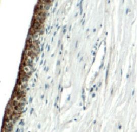 Uroplakin II Antibody - BSA Free