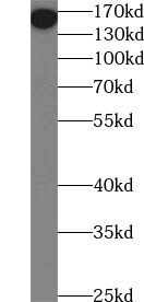 UHRF1BP1L Antibody - BSA Free