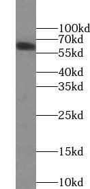 UGT8 Antibody - BSA Free