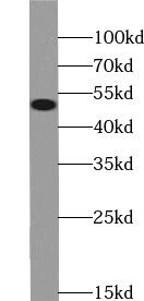 UGT3A2 Antibody - BSA Free