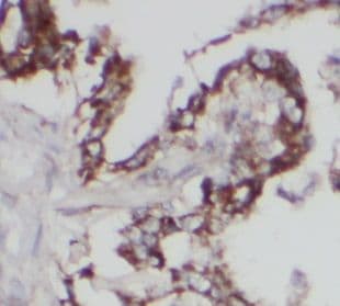 UGCG Antibody - BSA Free