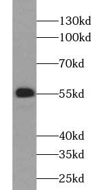 UGCG Antibody - BSA Free
